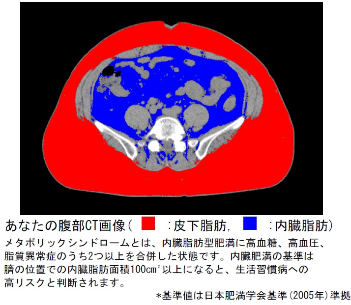 内臓脂肪